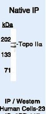 TOP2A Antibody in Immunoprecipitation (IP)
