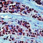 HSP90 alpha Antibody in Immunohistochemistry (Paraffin) (IHC (P))