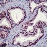 Androgen Receptor Antibody in Immunohistochemistry (Paraffin) (IHC (P))