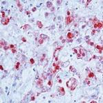 HSV Type 2 Antibody in Immunohistochemistry (IHC)
