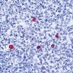 Rabbit anti-Human IgD (Heavy chain) Secondary Antibody