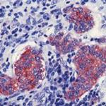 Synaptophysin Antibody in Immunohistochemistry (Paraffin) (IHC (P))