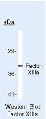 Factor XIII A Antibody in Western Blot (WB)