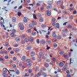 beta Catenin Antibody in Immunohistochemistry (Paraffin) (IHC (P))