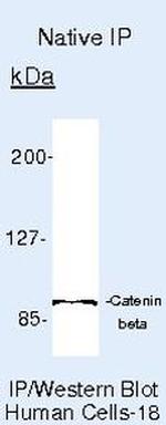 beta Catenin Antibody in Immunoprecipitation (IP)