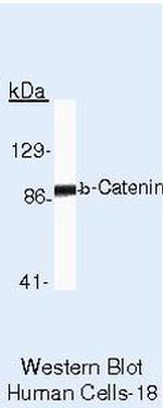 beta Catenin Antibody in Western Blot (WB)
