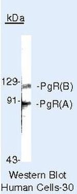 Progesterone Receptor Antibody in Western Blot (WB)