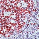 Ki-67 Antibody in Immunohistochemistry (Paraffin) (IHC (P))