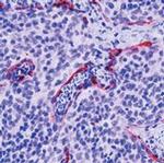 BAK Antibody in Immunohistochemistry (Paraffin) (IHC (P))