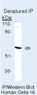 Estrogen Receptor alpha Antibody in Immunoprecipitation (IP)