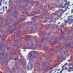 Pan-cadherin Antibody in Immunohistochemistry (Paraffin) (IHC (P))
