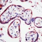 MMP1 Antibody in Immunohistochemistry (Paraffin) (IHC (P))