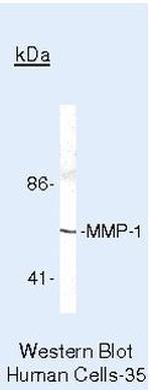 MMP1 Antibody in Western Blot (WB)