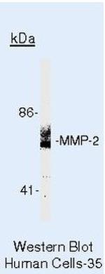 MMP2 Polyclonal Antibody