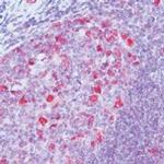 Cyclin A Antibody in Immunohistochemistry (Paraffin) (IHC (P))