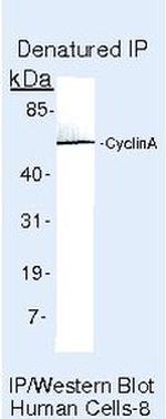Cyclin A Antibody in Immunoprecipitation (IP)