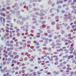 p57 Kip2 Antibody in Immunohistochemistry (Paraffin) (IHC (P))