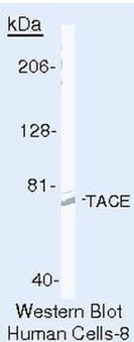 ADAM17 Antibody in Western Blot (WB)