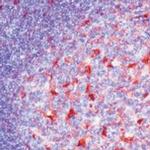 S100A6 Antibody in Immunohistochemistry (Paraffin) (IHC (P))