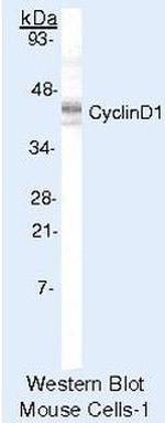 Cyclin D1 Antibody in Western Blot (WB)