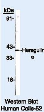NRG1 Antibody in Western Blot (WB)