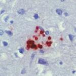 Toxoplasma Gondii Antibody in Immunohistochemistry (IHC)