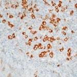 Kappa Light Chain Antibody in Immunohistochemistry (Paraffin) (IHC (P))