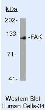 FAK Antibody in Western Blot (WB)