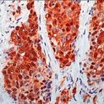 Calretinin Antibody in Immunohistochemistry (Paraffin) (IHC (P))