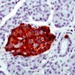 Chromogranin A Antibody in Immunohistochemistry (IHC)