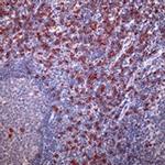 CD8 Antibody in Immunohistochemistry (Paraffin) (IHC (P))