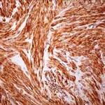 Alpha-Smooth Muscle Actin Antibody in Immunohistochemistry (Paraffin) (IHC (P))