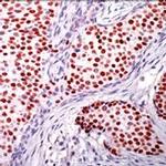 Progesterone Receptor Antibody in Immunohistochemistry (IHC)