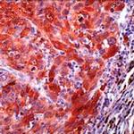 S100 Antibody in Immunohistochemistry (IHC)