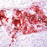 Cytokeratin 14 Polyclonal Antibody