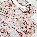 PDGFRA Antibody in Immunohistochemistry (Paraffin) (IHC (P))