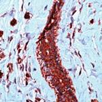 VEGF Antibody in Immunohistochemistry (IHC)