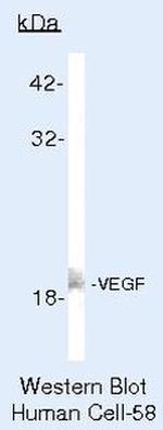 VEGF Antibody in Western Blot (WB)