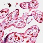 D4-GDI Antibody in Immunohistochemistry (IHC)