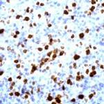 Ki-67 Antibody in Immunohistochemistry (Paraffin) (IHC (P))