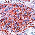 GLUT1 Antibody in Immunohistochemistry (Paraffin) (IHC (P))