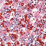 AFP Antibody in Immunohistochemistry (Paraffin) (IHC (P))