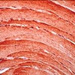 Myoglobin Antibody in Immunohistochemistry (IHC)