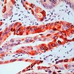 COX2 Antibody in Immunohistochemistry (IHC)