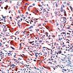 Osteopontin Antibody in Immunohistochemistry (Paraffin) (IHC (P))