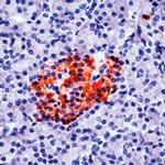 PGP9.5 Antibody in Immunohistochemistry (Paraffin) (IHC (P))