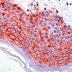 Claudin 1 Antibody in Immunohistochemistry (Paraffin) (IHC (P))