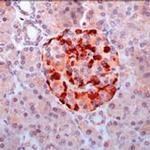 Survivin Antibody in Immunohistochemistry (IHC)