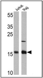 Survivin Antibody in Western Blot (WB)