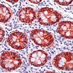 Claudin 3 Antibody in Immunohistochemistry (Paraffin) (IHC (P))